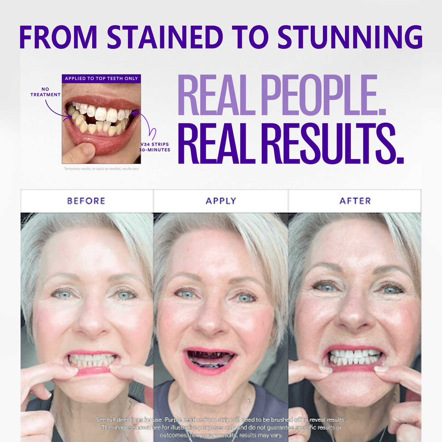 Clinclii™ V34 Whitening Strips – Professional Teeth Whitening at Home