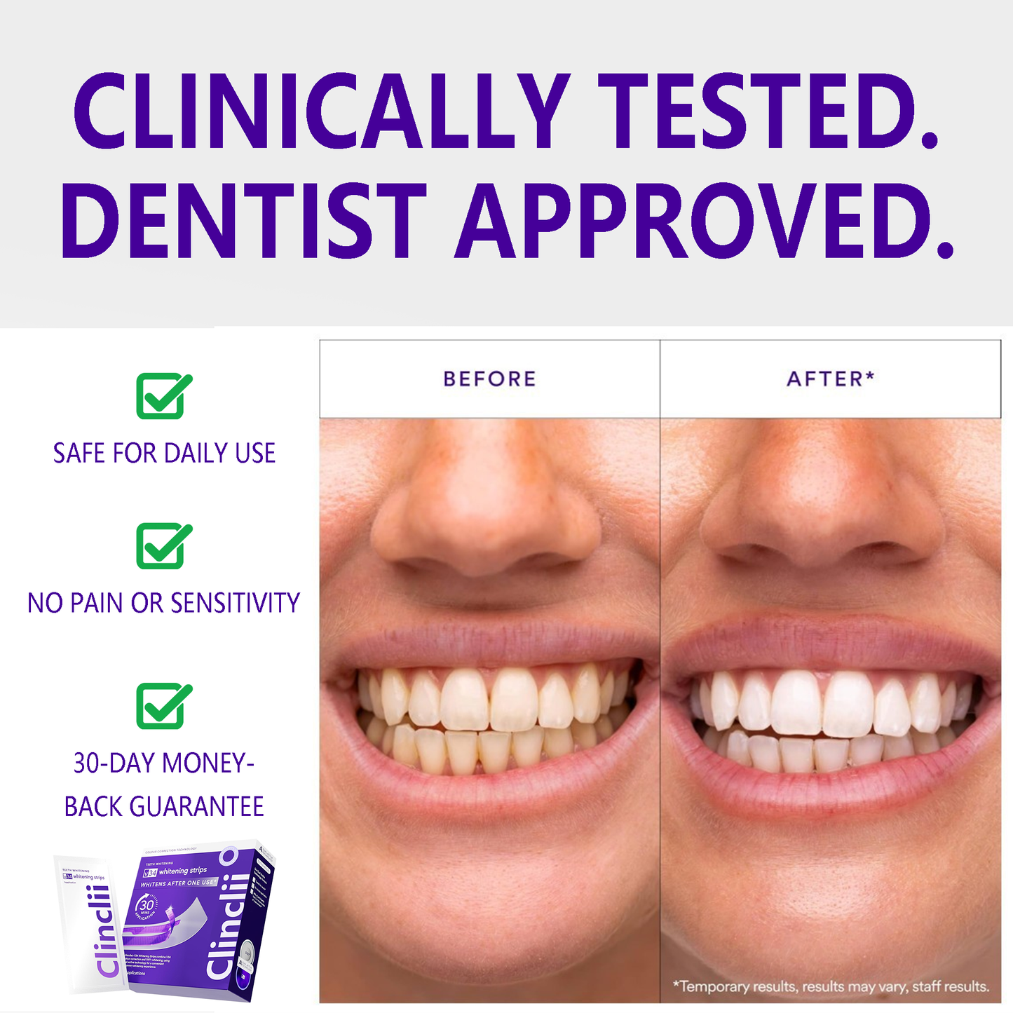 Clinclii™ V34 Whitening Strips – Professional Teeth Whitening at Home