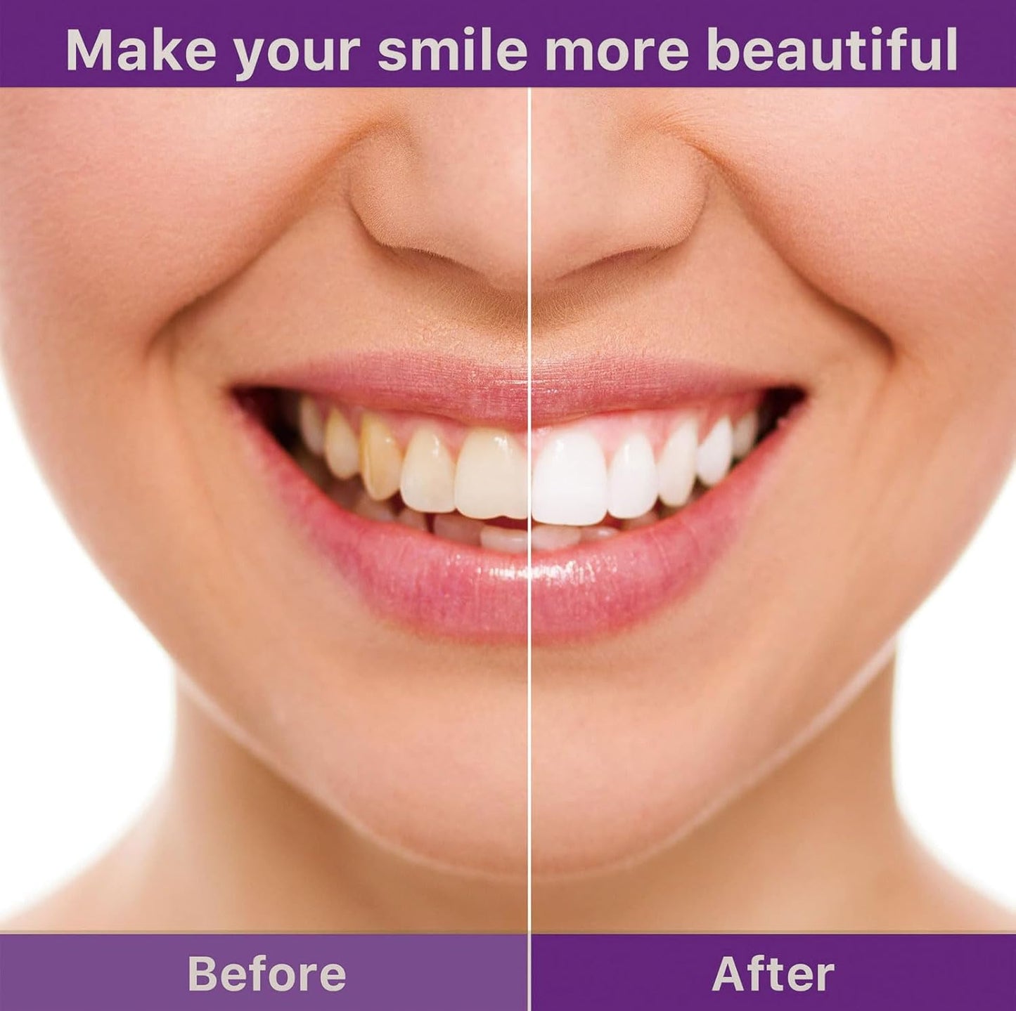 Clinclii™ V34 Whitening Strips – Professional Teeth Whitening at Home