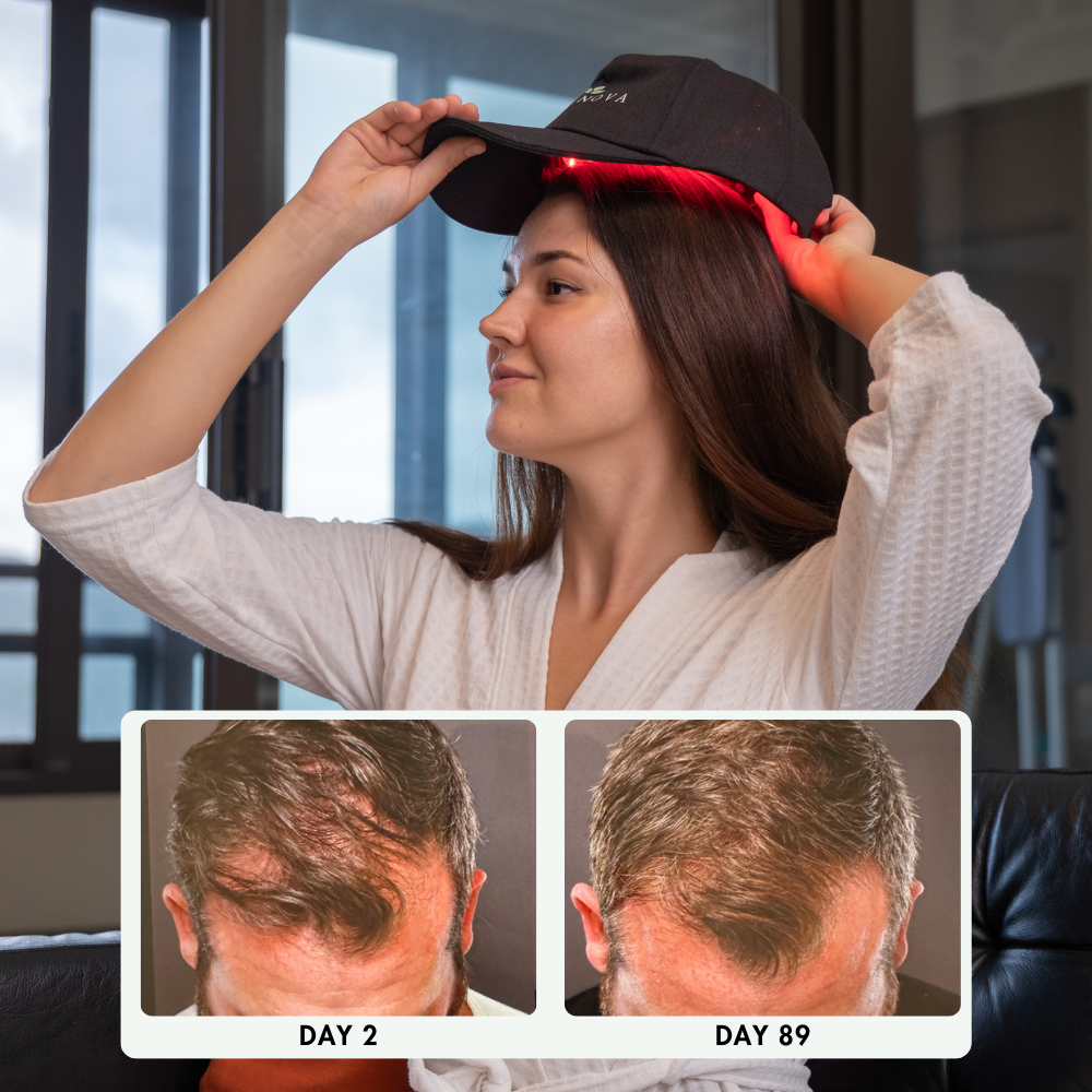 NESLEMY Hair Revive Pro